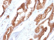 IHC staining of FFPE human prostate tissue with HSP27 antibody (clone CPTC-HSPB1-2). HIER: boil tissue sections in pH 9 10mM Tris with 1mM EDTA for 10-20 min and allow to cool before testing.