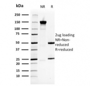SDS-PAGE analysis of purified, BSA-free HSP27 antibody (clone CPTC-HSPB1-2) as confirmation of integrity and purity.