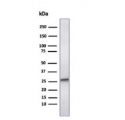 Western blot testing of human liver tissue lysate with HSP27 antibody (clone CPTC-HSPB1-2). Predicted molecular weight: 23-27 kDa.