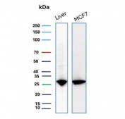 Western blot testing of human liver and MCF7 cell lysate with HSP27 antibody (clone CPTC-HSPB1-2). Predicted molecular weight: 23-27 kDa.