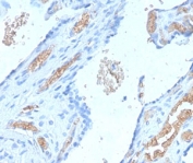 IHC staining of FFPE human placenta with recombinant Spectrin alpha 1 antibody (clone SCNA-1R). Required HIER: boil tissue sections in pH 9 10mM Tris with 1mM EDTA for 10-20 min followed by cooling at RT for 20 min.