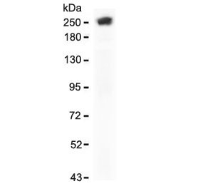 Western blot testing of human Hela cell lysate with recombinant SPTA1 antibody (clone SCNA-1R). Expected molecular weight: 260-280 kDa.~