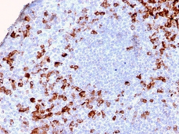IHC testing of FFPE human tonsil tissue with recombinant Kappa antibody (clone KLC2886R). Required HIER: boil tissue sections in pH 9 10mM Tris with 1mM EDTA for 10-20 min followed by cooling at RT for 20 min.~