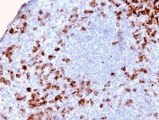 IHC testing of FFPE human tonsil tissue with recombinant Kappa antibody (clone KLC2886R). Required HIER: boil tissue sections in pH 9 10mM Tris with 1mM EDTA for 10-20 min followed by cooling at RT for 20 min.
