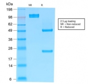 SDS-PAGE analysis of purified, BSA-free recombinant IgM Heavy Chain antibody (clone rIM373) as confirmation of integrity and purity.
