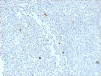 IHC staining of FFPE human tonsil tissue with recombinant IgM Heavy Chain antibody (clone rIM373). HIER: boil tissue sections in pH6, 10mM citrate buffer, for 10-20 min and allow to cool before testing.~