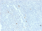 IHC staining of FFPE human tonsil tissue with recombinant IgM Heavy Chain antibody (clone rIM373). HIER: boil tissue sections in pH6, 10mM citrate buffer, for 10-20 min and allow to cool before testing.