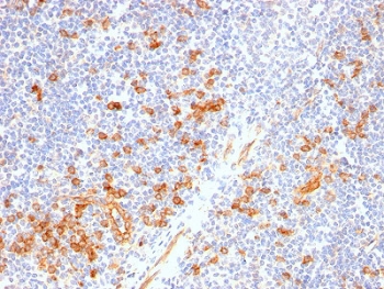 IHC staining of FFPE human tonsil with recombinant CD123 antibody (clone IL3RA/2947R). HIER: boil tissue sections in 10mM Tris with 1mM EDTA, pH 9 for 10-20 min and allow to cool.~