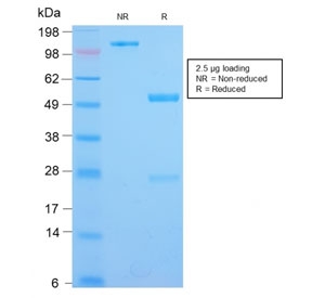 SDS-PAGE analysis of purified, BSA-free recombinant CD12