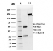 SDS-PAGE analysis of purified, BSA-free Cytokeratin 15 antibody (clone KRT15/2554) as confirmation of integrity and purity.
