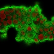 Immunofluorescent staining of permeabilized human MCF7 cells with recombinant CK18 antibody antibody (clone KRT18/2808R, green) and Reddot nuclear stain (red).