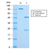 SDS-PAGE analysis of purified, BSA-free recombinant CK18 antibody (clone KRT18/2808R) as confirmation of integrity and purity.
