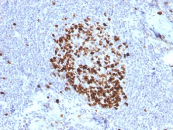 IHC testing of FFPE human tonsil stained with Ki-67 antibody (MKI67/2466). Required HIER: boiling tissue sections in 10mM citrate buffer, pH6, for 10-20 min followed by cooling at RT for 20 min.