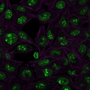 Immunofluorescent staining of human HeLa cells with Ki-67 antibody (green, clone MKI67/2466) and Phalloidin (purple, membrane stain).