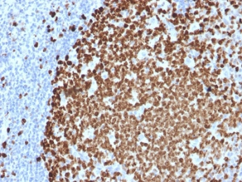 IHC testing of FFPE human tonsil stained with Ki67 antibody (MKI67/2461). Required HIER: boiling tissue sections in pH 9 10mM Tris with 1mM EDTA for 10-20 min followed by cooling at RT for 20 min.~