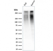 Western blot testing of human Raji and Ramos cell lysate with Ki67 antibody (clone MKI67/2461). Predicted molecular weight ~350 kDa.