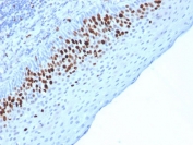 IHC testing of FFPE human skin stained with Ki67 antibody (MKI67/2463). Required HIER: boiling tissue sections in 10mM citrate buffer, pH6, for 10-20 min followed by cooling at RT for 20 min.