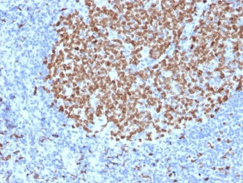 IHC testing of FFPE human tonsil stained with Ki67 antibody (MKI67/2463). Required HIER: boiling tissue sections in 10mM citrate buffer, pH6, for 10-20 min followed by cooling at RT for 20 min.~