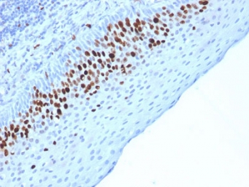 IHC testing of FFPE human skin stained wit