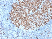 IHC testing of FFPE human tonsil stained with Ki67 antibody (MKI67/2463). Required HIER: boiling tissue sections in 10mM citrate buffer, pH6, for 10-20 min followed by cooling at RT for 20 min.