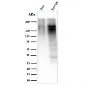 Western blot testing of human Raji and Ramos cell lysate with Ki67 antibody (clone MKI67/2463). Expected molecular weight ~350 kDa.