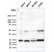 Western blot testing of human HeLa, MCF-7, SK-Br3 and T47D cell lysate with recombinant Mammaglobin antibody (clone MGB/2682R). Expected molecular weight: 10-21 kDa depending on level of glycosylation.