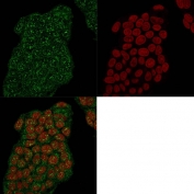 Immunofluorescent staining of permeabilized human MCF7 cells with recombinant Mammaglobin antibody (clone MGB/2682R, green) and Reddot nuclear stain (red).