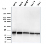 Western blot testing of human HeLa, A431, HepG2, HAP1 and U937 cell lysate with recombinant MTAP antibody (clone MTAP/3137R). Expected molecular weight: 26-38 kDa (multiple isoforms).