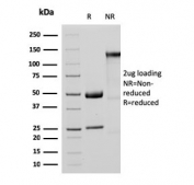 SDS-PAGE analysis of purified, BSA-free recombinant MTAP antibody (clone MTAP/3137R) as confirmation of integrity and purity.