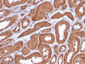 MTAP Antibody Kidney IHC. Immunohistochemical analysis of Methylthioadenosine phosphorylase (MTAP) in formalin-fixed, paraffin-embedded human kidney tissue using MTAP antibody clone MTAP/3137R. Strong cytoplasmic staining is observed in renal tubular epithelial cells, consistent with MTAP expression in metabolically active tissues. HIER: steam sections in pH 9 10 mM Tris with 1 mM EDTA for 20 min followed by cooling prior to staining.