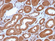 MTAP Antibody Renal Tubule IHC. Immunohistochemical analysis of MTAP expression in FFPE human kidney tissue using MTAP antibody clone MTAP/3137R. Diffuse cytoplasmic staining highlights tubular epithelial structures, while surrounding stromal elements show lower signal, reflecting tissue-specific metabolic activity. HIER: steam sections in pH 9 10 mM Tris with 1 mM EDTA for 20 min followed by cooling prior to staining.