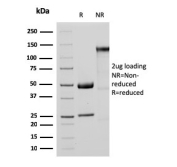 MTAP Antibody SDS-PAGE (Reducing vs Non-Reducing). SDS-PAGE analysis of MTAP antibody clone MTAP/3137R under reducing (R) and non-reducing (NR) conditions. Bands corresponding to antibody heavy and light chains are observed under reducing conditions, reflecting expected antibody structure.