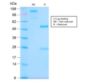 SDS-PAGE analysis of purified, BSA-free recombinant MUC1 antibody (clone MUC1/2980R) as confirmation of integrity and purity.