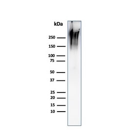 Western blot testing of human MCF7 cell lysate with recombinant MUC1 antibody (clone MUC1/2980R). This glycoprotein is commonly visualized between 120~500 kDa.~