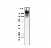 Western blot testing of human MCF7 cell lysate with recombinant MUC1 antibody (clone MUC1/2980R). This glycoprotein is commonly visualized between 120~500 kDa.
