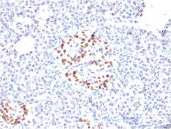 IHC staining of FFPE human pancreas with NKX6.1 antibody. HIER: boil tissue sections in pH6, 10mM citrate buffer, for 10-20 min and allow to cool before testing.~