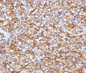 IHC testing of FFPE human pancreas with recombinant SPTBN2 antibody (clone SCNB3-2R). Required HIER: boil tissue sections in pH 9 10mM Tris with 1mM EDTA for 10-20 min followed by cooling at RT for 20 min.