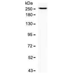 Western blot testing of human PANC-1 cell lysate with recombinant SPTBN2 antibody (clone SCNB3-2R). Predicted molecular weight ~246 kDa.~