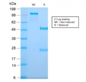 SDS-PAGE analysis of purified, BSA-free recombinant TMEM16A antibody (clone DG1/2831R) as confirmation of integrity and purity.