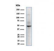 Western blot testing of human HepG2 cell lysate with SOX9 antibody. Predicted molecular weight: 56-65 kDa.