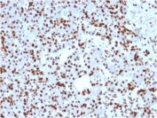 IHC staining of FFPE human pancreas with SOX9 antibody. HIER: boil tissue sections in pH 9 10mM Tris with 1mM EDTA for 10-20 min followed by cooling at RT for 20 min.