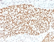 IHC staining of FFPE human pancreas with SOX9 antibody. HIER: boil tissue sections in pH 9 10mM Tris with 1mM EDTA for 10-20 min followed by cooling at RT for 20 min.