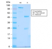 SDS-PAGE analysis of purified, BSA-free recombinant pS2 antibody (clone TFF1/2969R) as confirmation of integrity and purity.