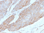 IHC testing of FFPE human pancreas with recombinant Spectrin beta III antibody (clone SPTBN2/2979R). Required HIER: boil tissue sections in 10mM citrate buffer, pH 6, for 10-20 min followed by cooling at RT for 20 min.