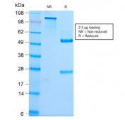 SDS-PAGE analysis of purified, BSA-free recombinant Spectrin beta III antibody (clone SPTBN2/2979R) as confirmation of integrity and purity.
