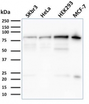 Western blot testing of human SK-BR-3, HeLa, HEK293 and MCF-7 cell lysate with Ezrin antibody. Expected molecular weight: 70-80 kDa.