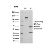 SDS-PAGE analysis of purified, BSA-free Ezrin antibody (clone CPTC-Ezrin-1) as confirmation of integrity and purity.