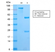 SDS-PAGE analysis of purified, BSA-free recombinant PAX8 antibody (clone PAX8/2774R) as confirmation of integrity and purity.