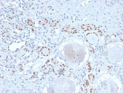 IHC testing of FFPE human kidney with PAX8 antibody (clone PAX8/2774R). Required HIER: boil tissue sections in 10mM Tris buffer with 1mM EDTA, pH 9, for 10-20 min and allow to cool before testing.