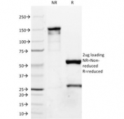 SDS-PAGE analysis of purified, BSA-free ZAP70 antibody (clone TP63/11) as confirmation of integrity and purity.